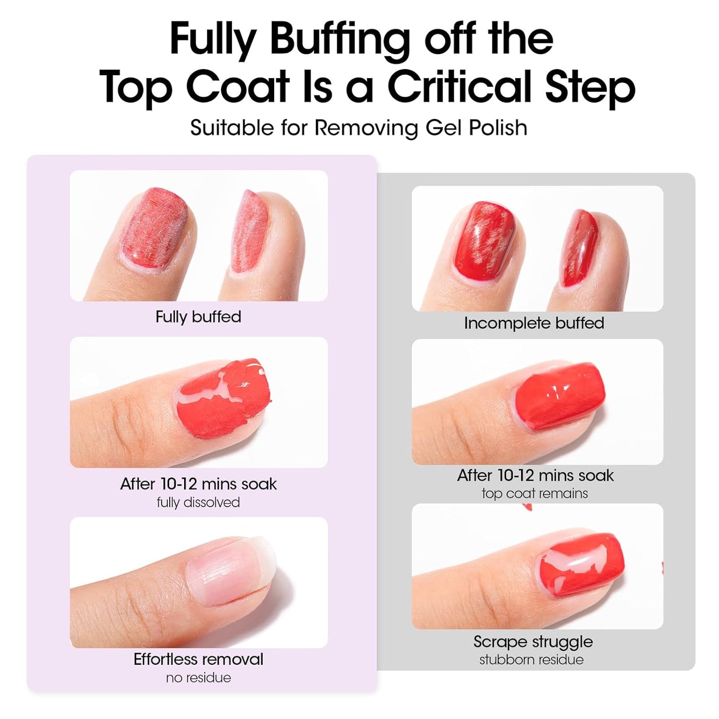 GELLEN Acetone Nail Polish Remover Pads, Professional Gel Polish Remover Pads, 200 Pack Travel Bulk Set with Tools, Individually Wrapped Quick & Effective Soak Off Remover for Salon Home